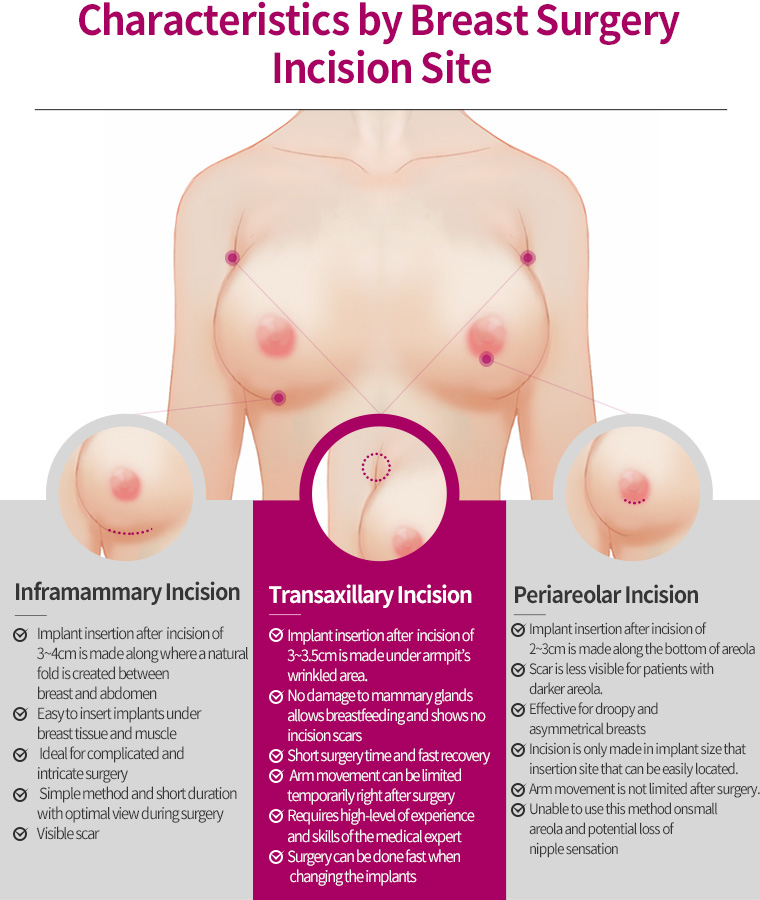 Characteristics by Breast Surgery Incision Site
